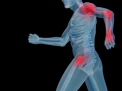Efectele antiinflamatorii ale turmericului asupra osteoartritei